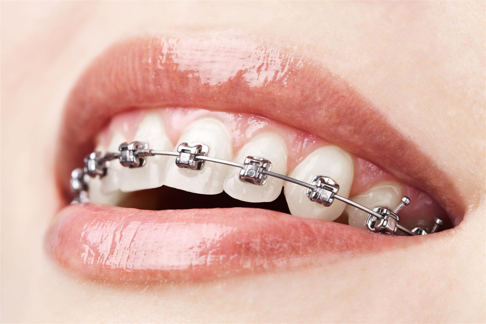 Orthodontie